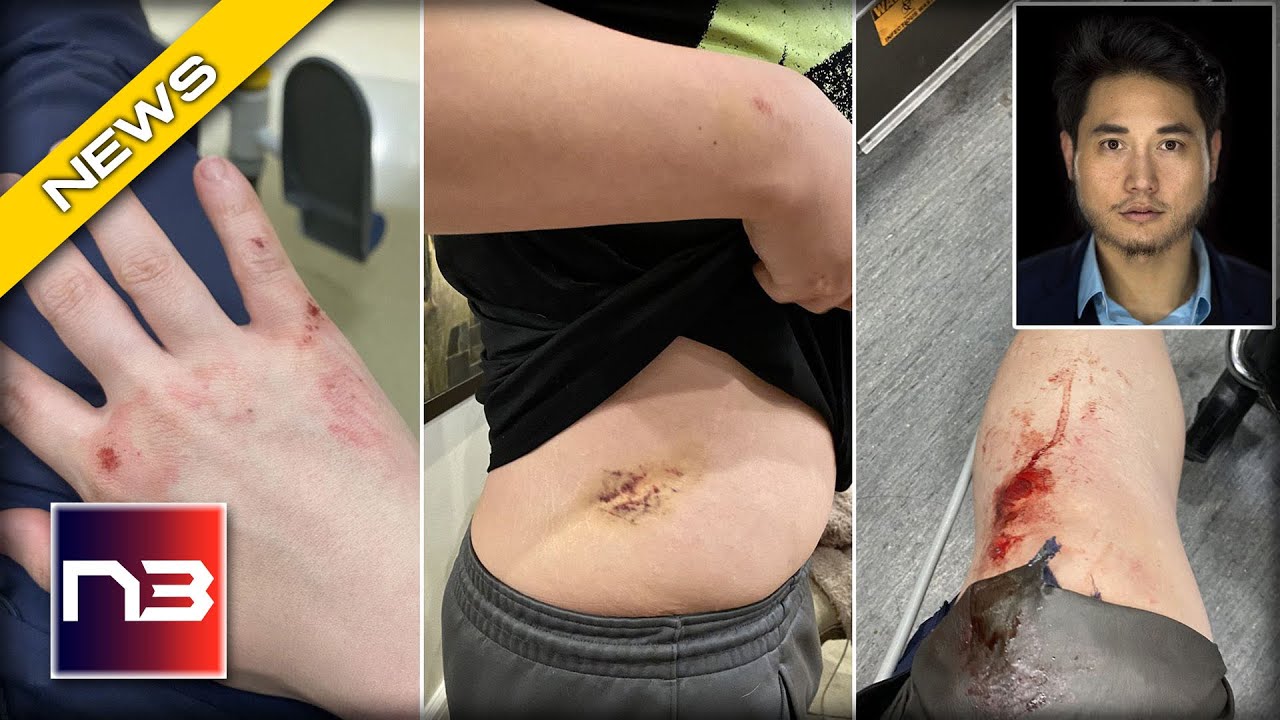 Journalist Andy Ngo Brutally Attacked in Portland by Antifa - He Needs Prayers NOW