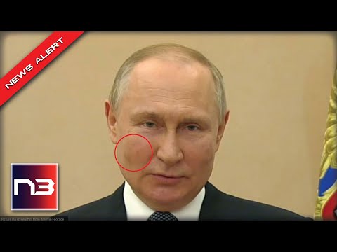 People Noticed That Putin Had Dark Splotches On His Cheeks, Here’s What It Could Be