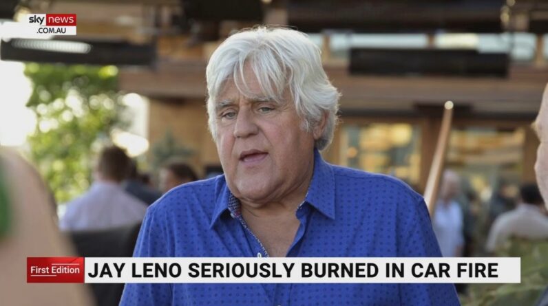 Jay Leno seriously burnt after car fire