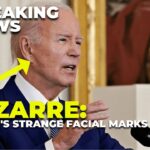 Decoded: Biden's Facial Markings Reveal Hidden Health Battle