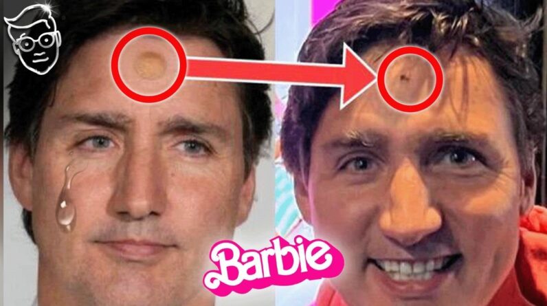 What The Hell Is Wrong With Justin Trudeau? Divorce, Open Wound On Face, Pink Barbie Simp Post WTF!